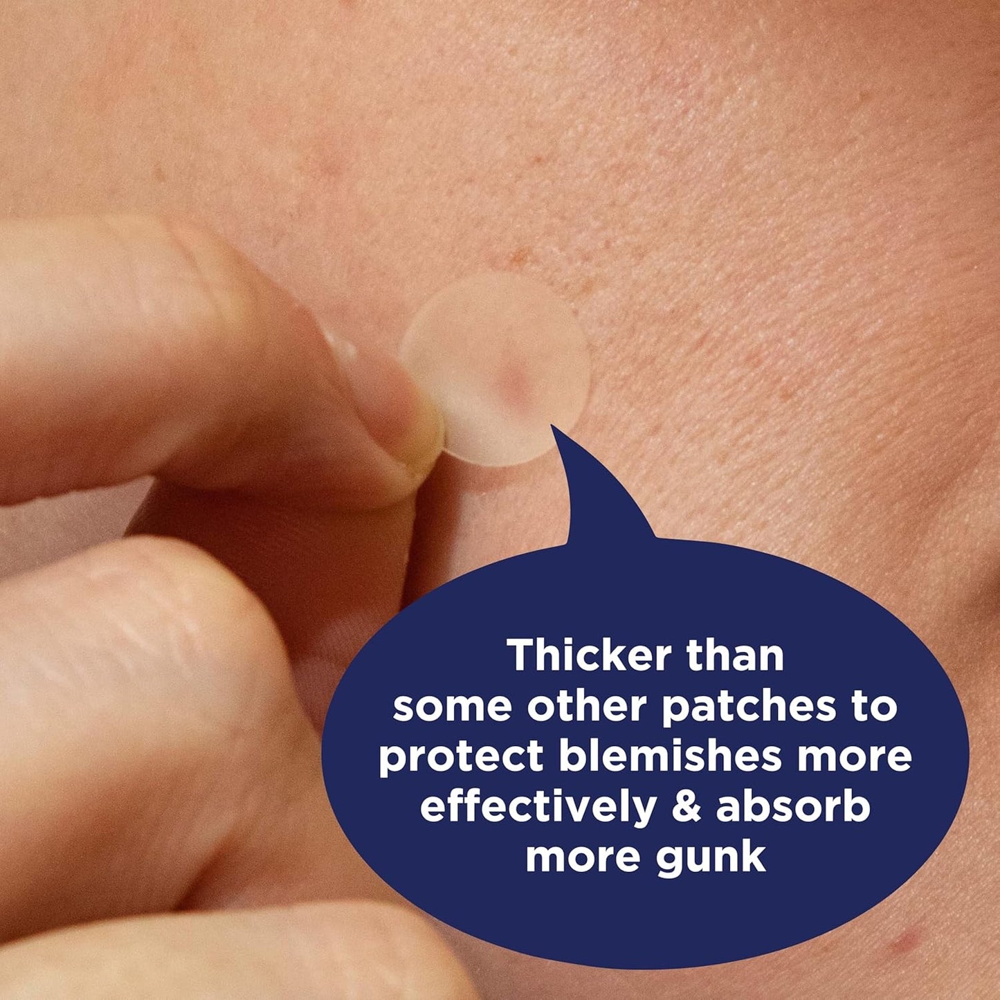 PanOxyl PM Overnight Spot Patches – Advanced Hydrocolloid Healing Technology – Fragrance-Free – 40 Count